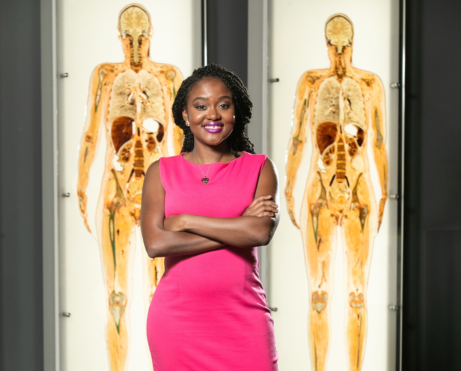 Arlyne Simon stands in front of two body scans.