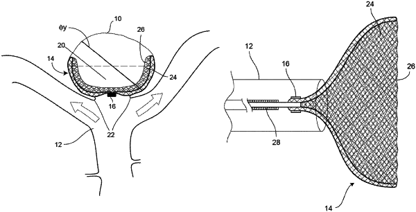OG exemplary drawing